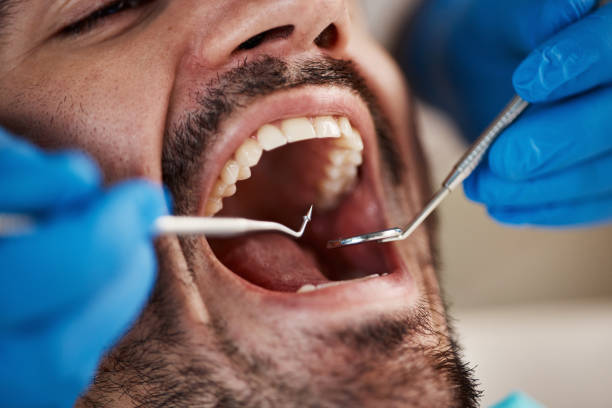 Best Emergency Dental Care for Sports Injuries in Durand, WI